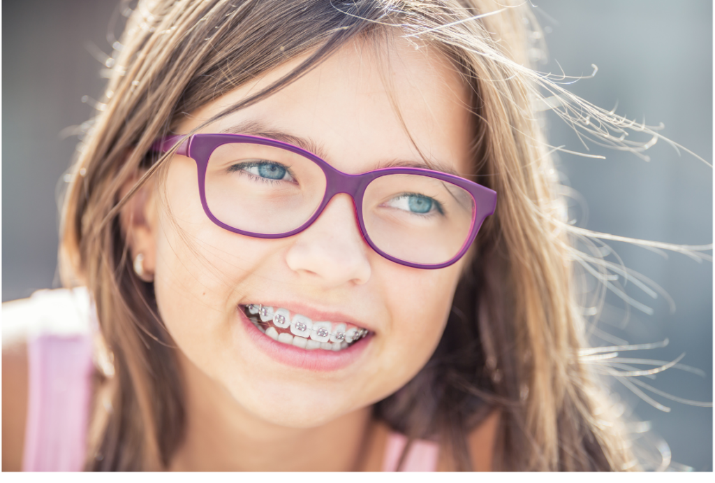 Dental Braces : Perawatan Ortodonti Untuk Susunan Gigi yang Ideal